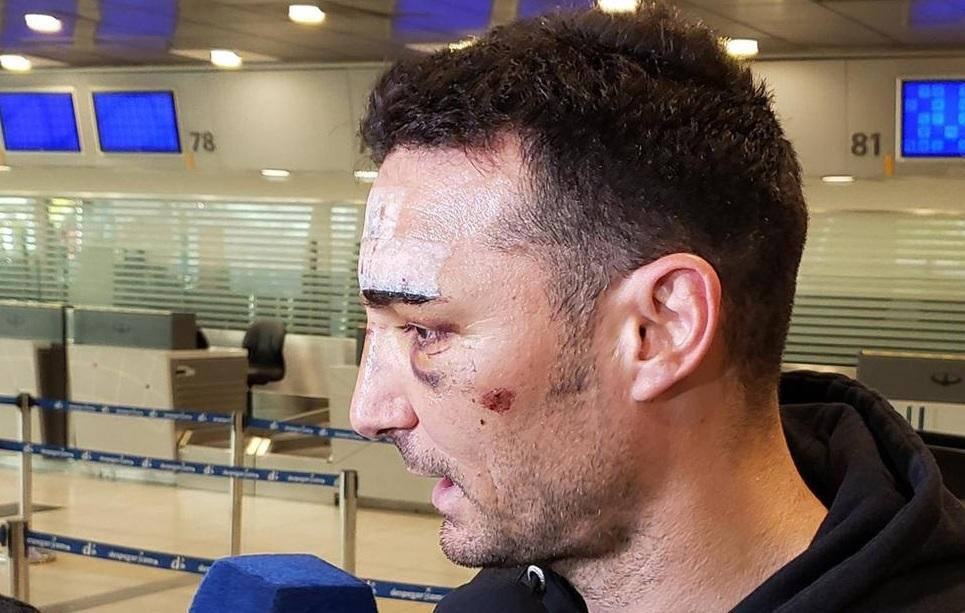 Regreso al país de Lionel Scaloni tras accidente en Mallorca