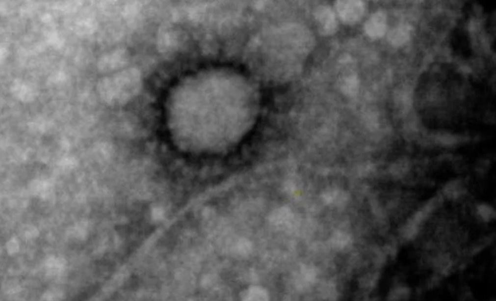 Coronavirus, Argentina, primera foto del virus circulante