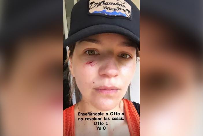 Marcela Kloosterboer sufrió heridas en su rostro