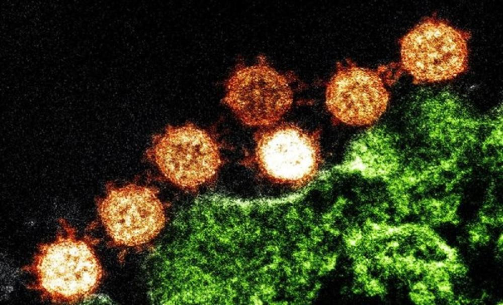 Coronavirus en el mundo, foto artística