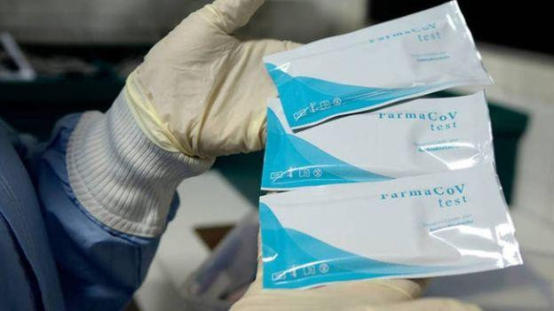 La ANMAT aprobó un test de coronavirus 