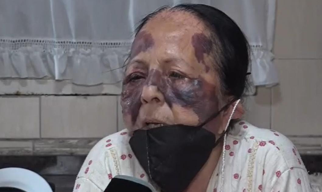 Mujer anciana golpeada en robo