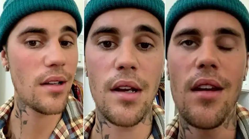 Justin Bieber fue diagnosticado con un raro trastorno