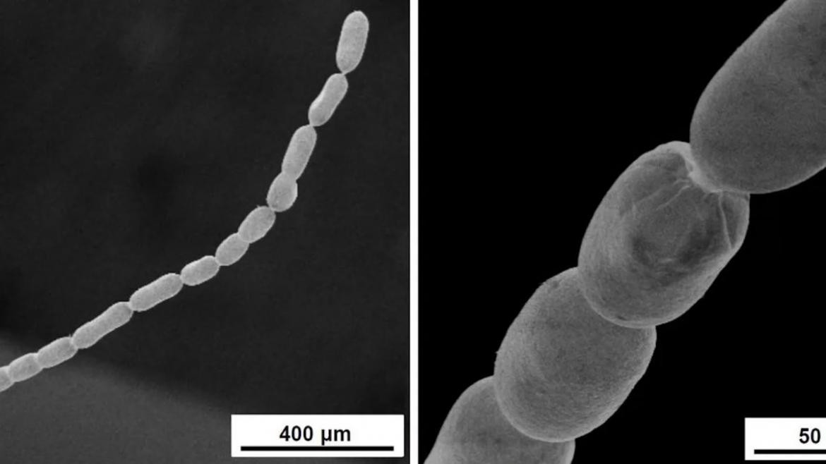 Descubrimiento, bacteria. Foto: EFE.