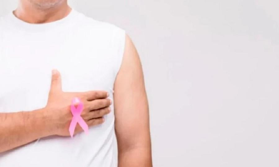 Cáncer de mama en hombres. NA.