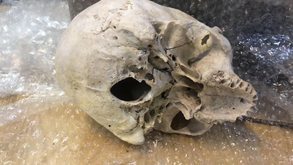 Aduana encontró una calavera en una encomienda postal que iba dirigida a Estados Unidos	