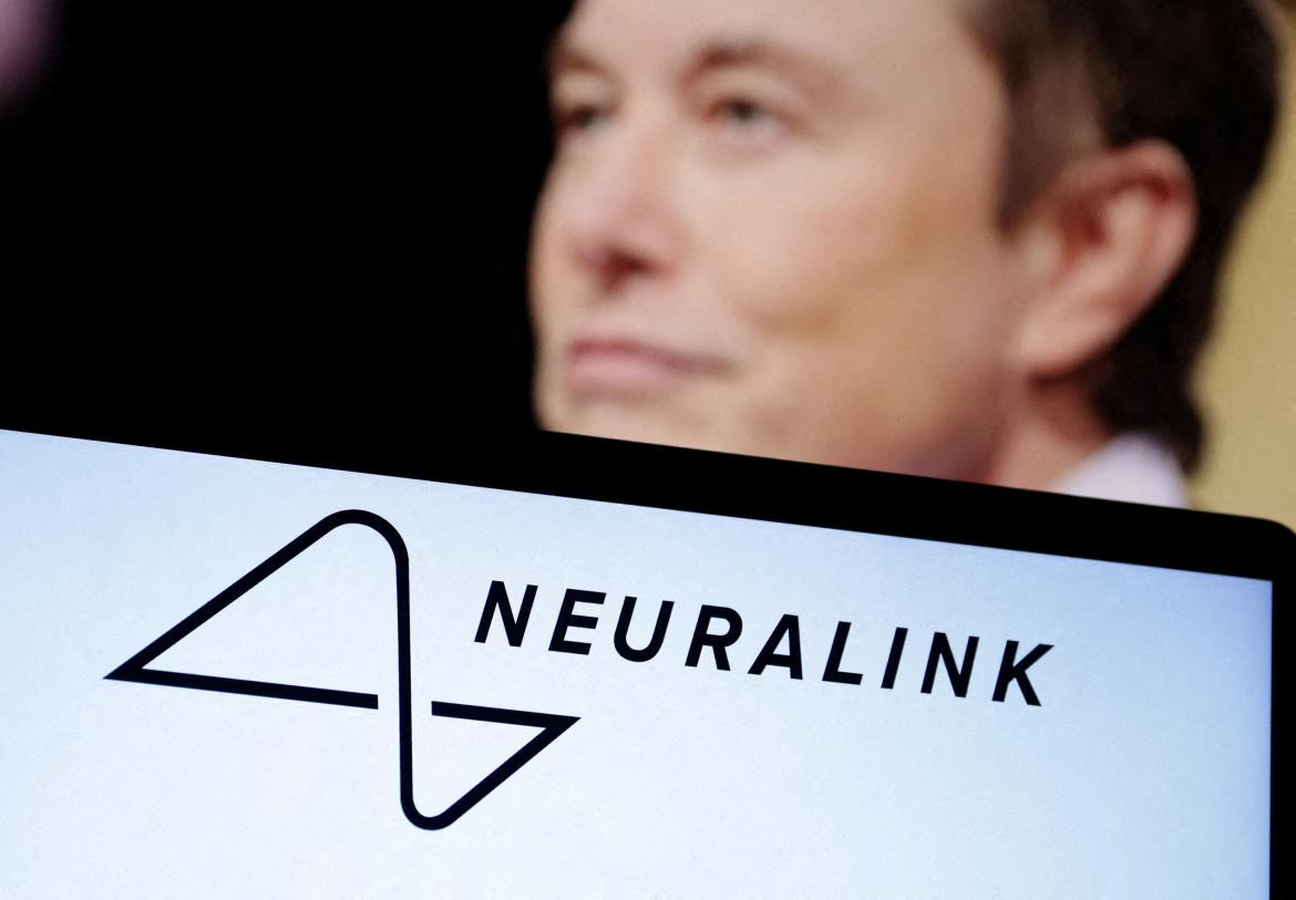 Neuralink, la empresa neurotecnología de Elon Musk. Foto: Reuters.