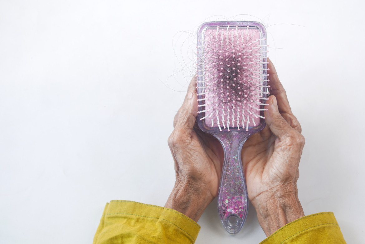 Caída de pelo, alopecia. Foto: Unsplash