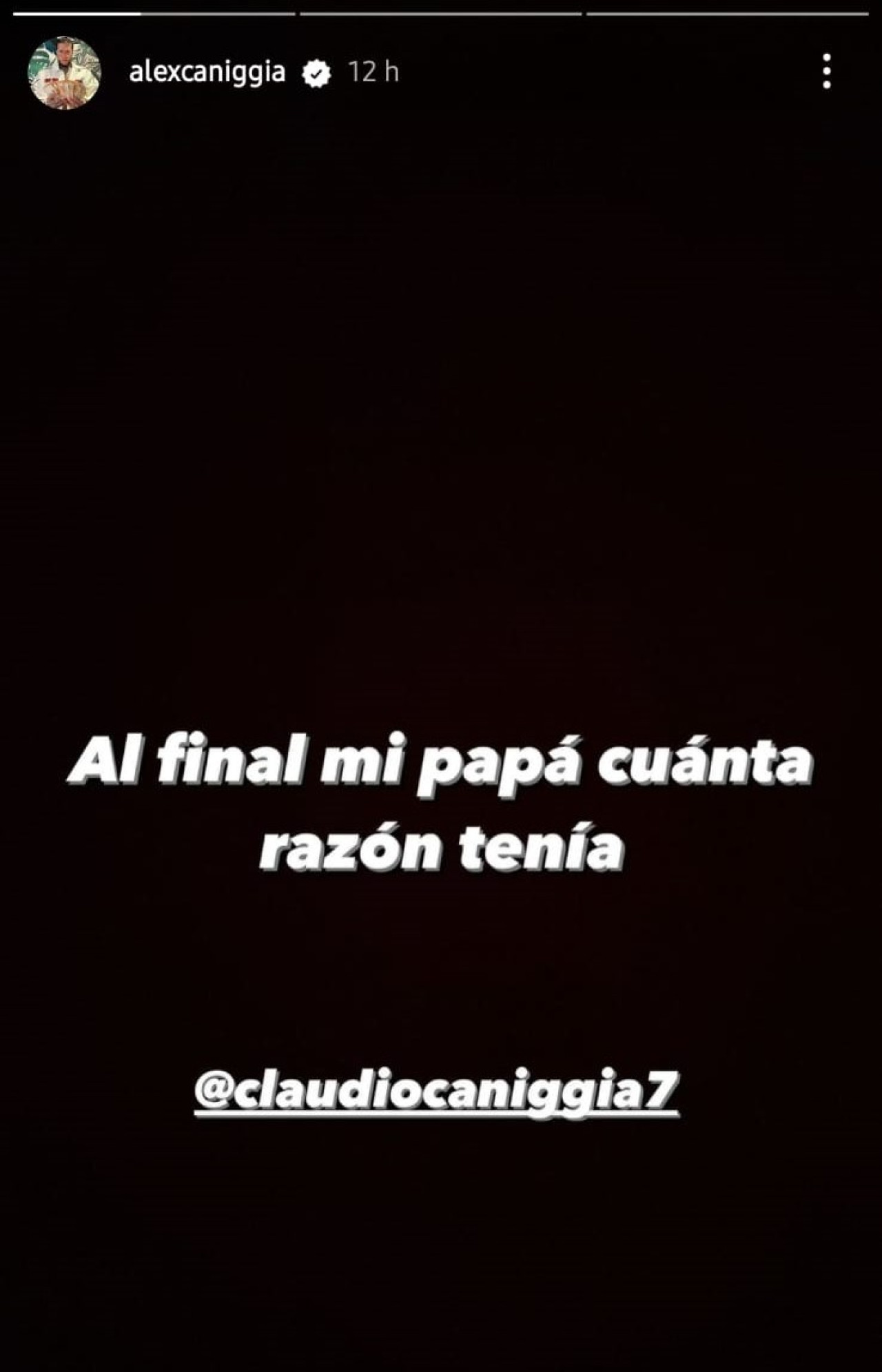 Las historias de Alex Caniggia. Foto: Instagram.