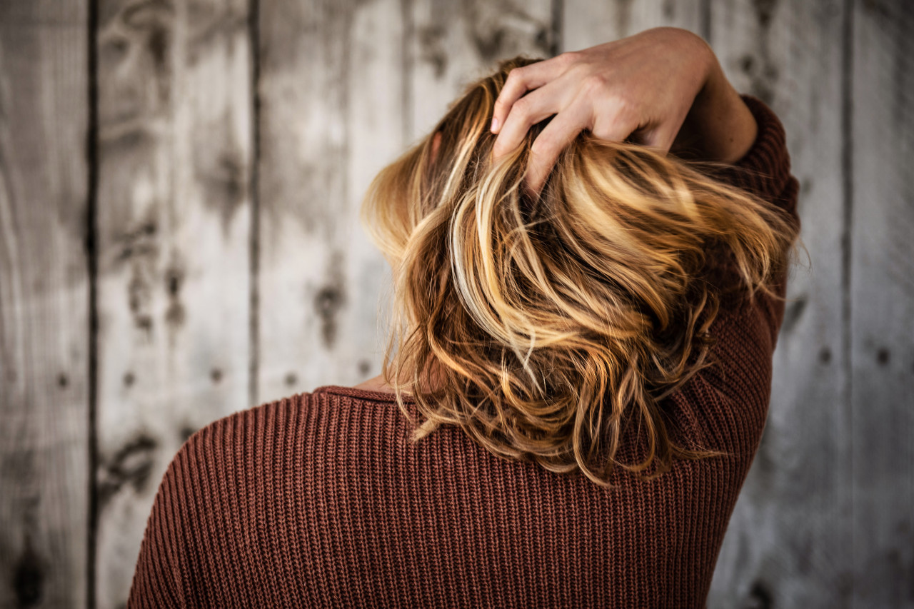 ¿Cuáles son las vitaminas esenciales para evitar la caída de cabello?. Foto: Unsplash