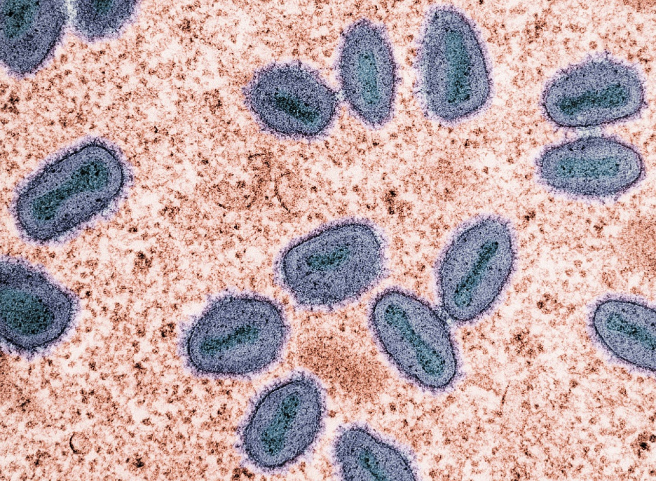 Mpox, viruela símica. Foto: Unsplash.