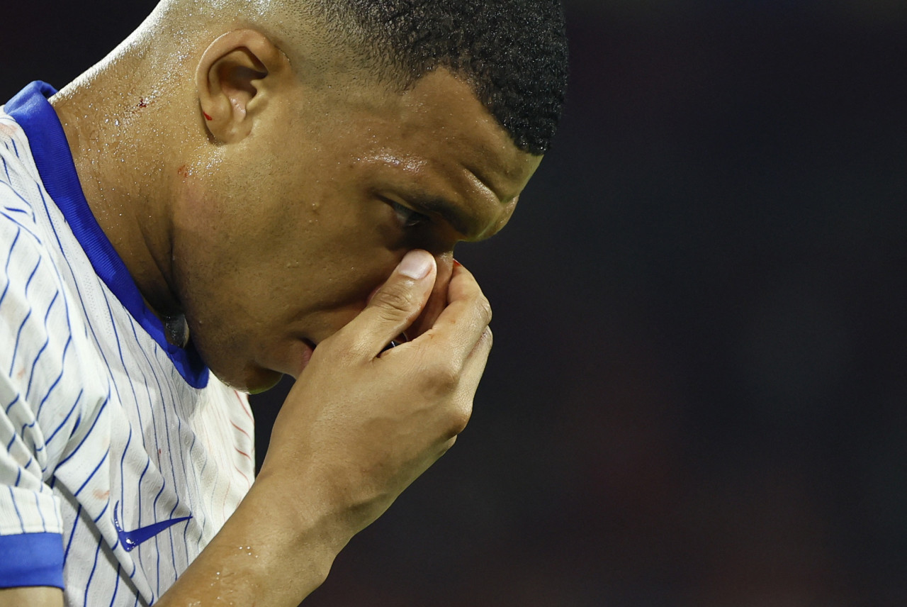 Mbappé se fracturó la nariz en el debut de Francia en la Eurocopa. Foto: Reuters