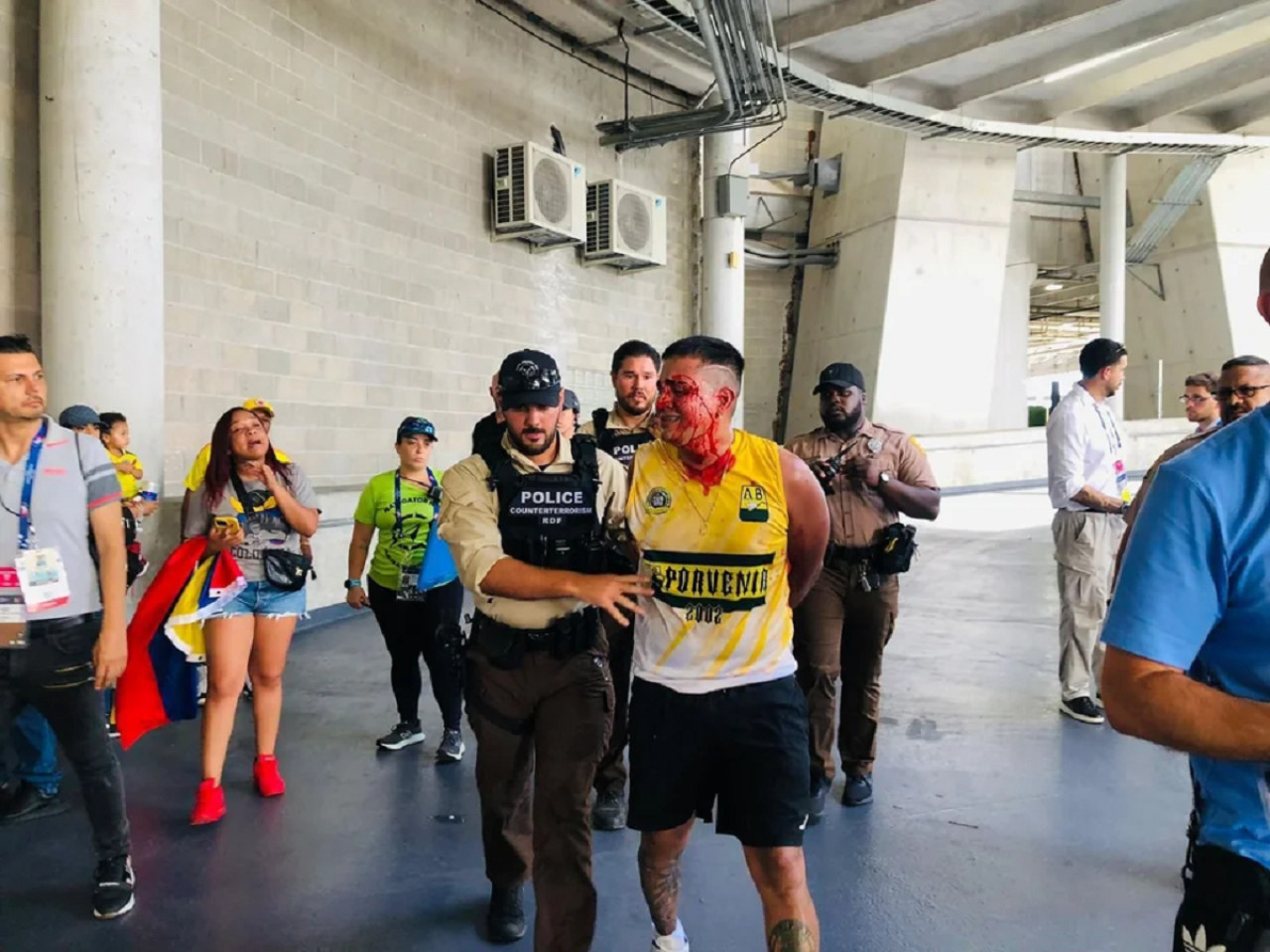 Incidentes en Argentina-Colombia, Copa América. Foto: NA