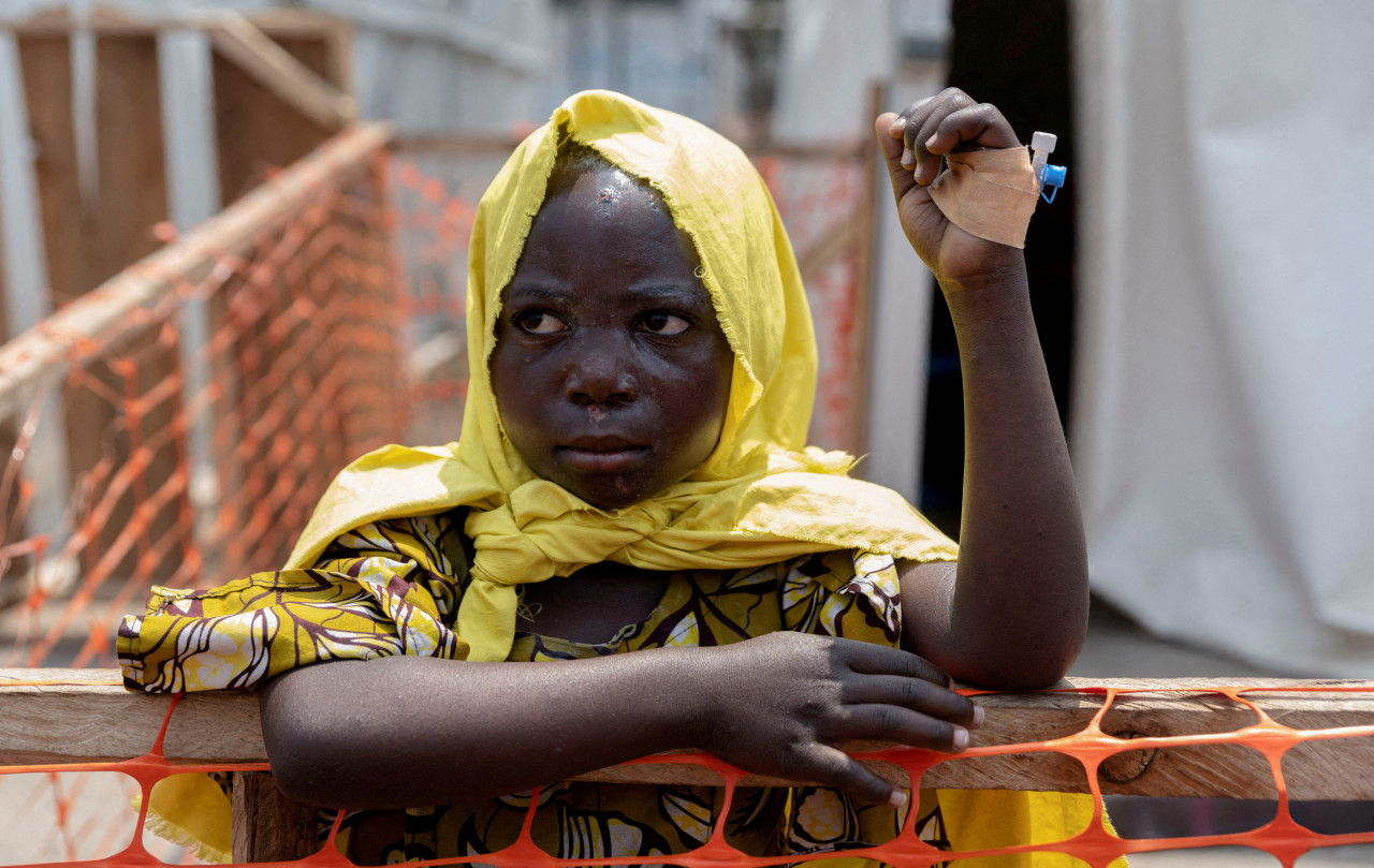 Mpox virus; viruela del mono. Foto: Reuters.