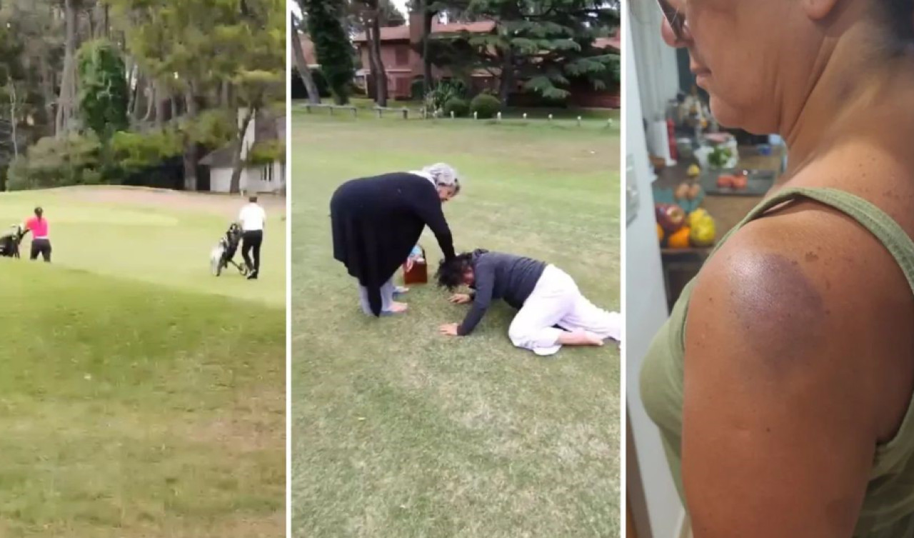 La golpiza que recibió la mujer de 61 años en el campo de golf. Foto: X.