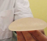 Implantes