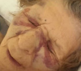 Anciana golpeada