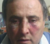 Director agredido en Mendoza (El Sol)