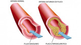 Colesterol