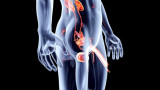 Sexo y cáncer de próstata