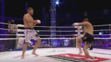 Fractura de un boxeador 