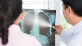 Cáncer (Shutterstock)  