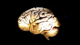 Cerebro