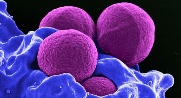 Bacteria resistente a los antibióticos