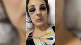 Mujer golpeada por futbolista