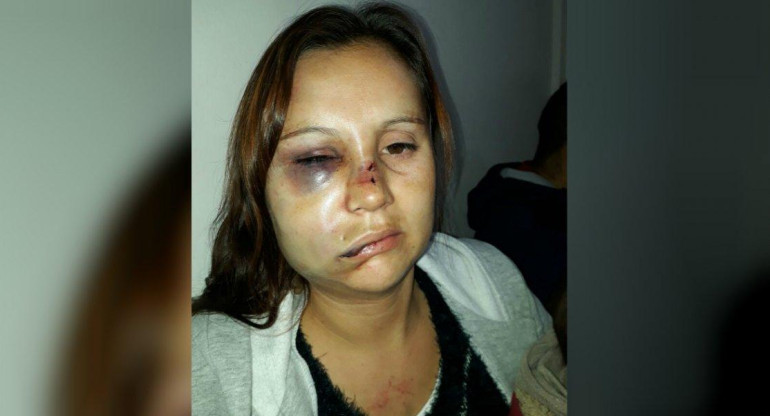 María Lorena Mendez, víctima de violencia de género