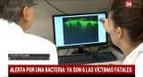 Dra. Celeste Celano - Bacteria del estreptococo - Salud - Canal 26