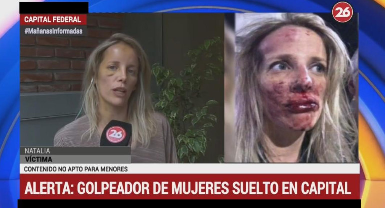 Mujer golpeada en Caballito - Canal 26