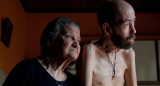 Fabián Tomasi, víctima del glifosato