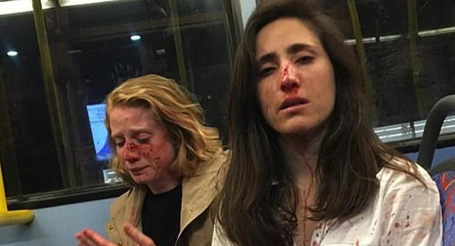 Azafata uruguay y novia agredidas en Londres 