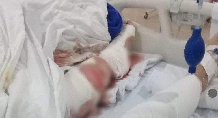 Mujer atacada por tres perros en Mar del Plata