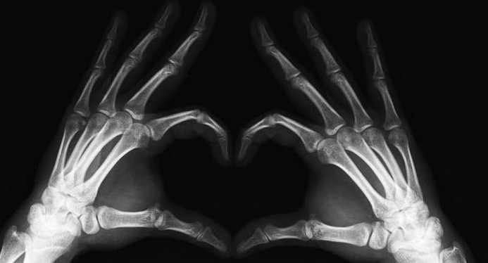 8 de noviembre:Se celebra el Día Mundial de la Radiología