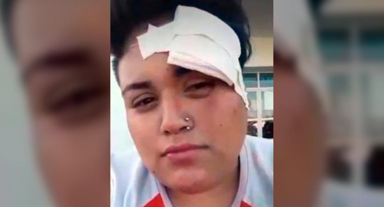 Mujer golpeada por patota, González Catán, violencia de género