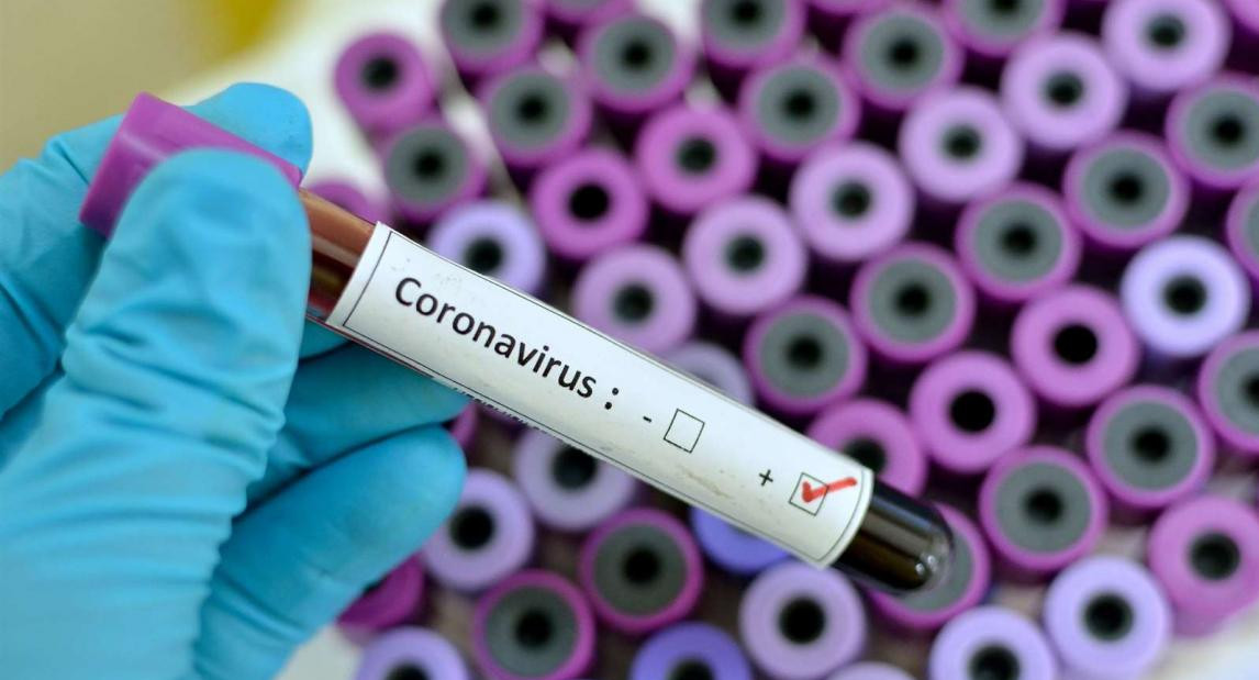 Coronavirus, COVID-19, hospitales, estudios médicos, enfermedad