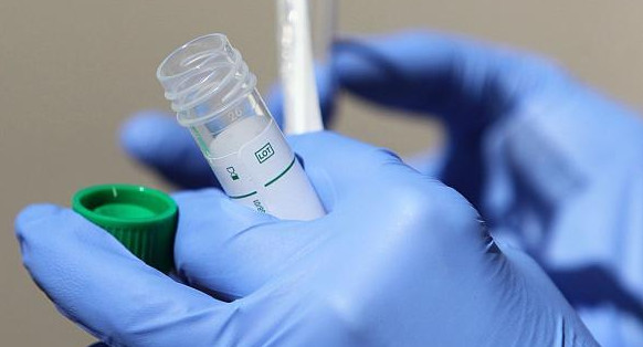 Francia desarrolla un test rápido para el coronavirus