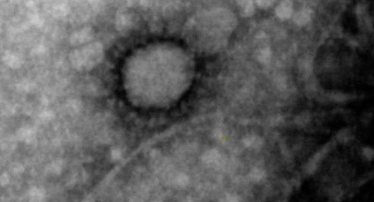 Coronavirus, Argentina, primera foto del virus circulante