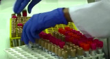Coronavirus en Francia, ciencia, médicos, laboratorio, REUTERS