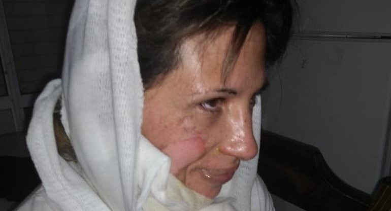 Mujer quemada en Bahía Blanca