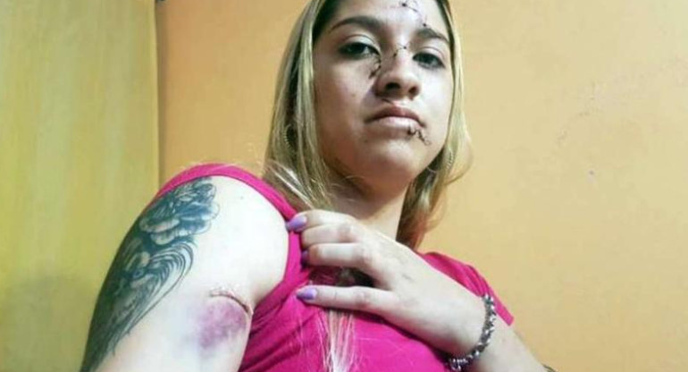 Melisa, joven agredida en Córdoba