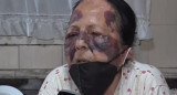 Mujer anciana golpeada en robo