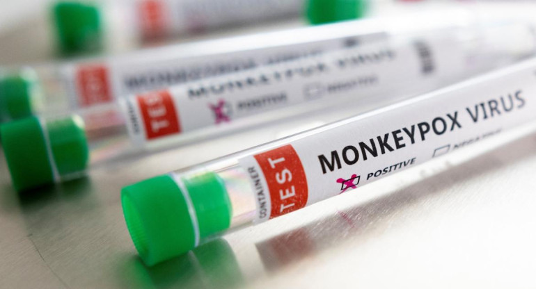 Test contra viruela del mono, Foto Reuters