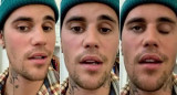 Justin Bieber fue diagnosticado con un raro trastorno