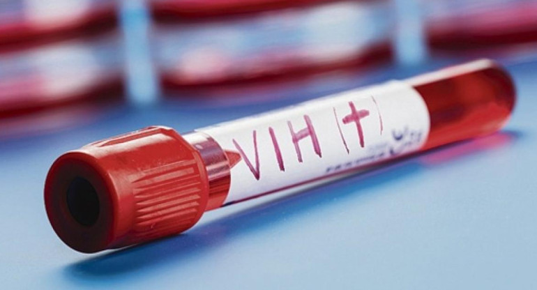 VIH, salud. Foto: EFE.