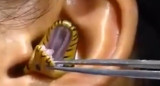 Serpiente en la oreja. Foto: captura de video.