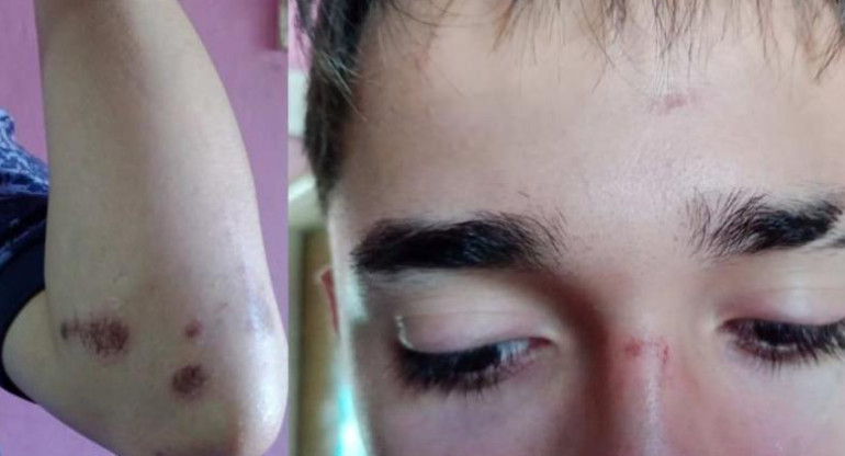 Así quedó el joven atacado a la salida de un boliche en Cañuelas. Foto: NA