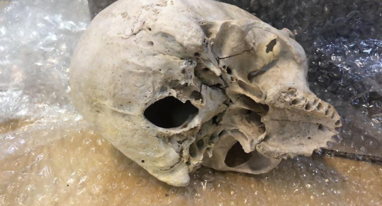 Aduana encontró una calavera en una encomienda postal que iba dirigida a Estados Unidos	